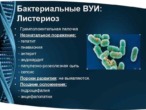 Внутриутробные инфекции