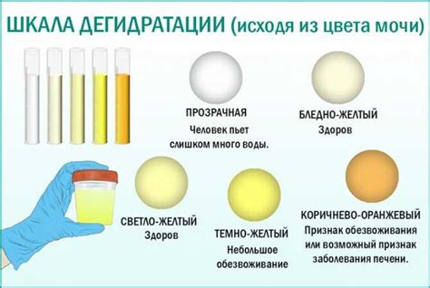 Вода - ключевой фактор для определения цвета мочи