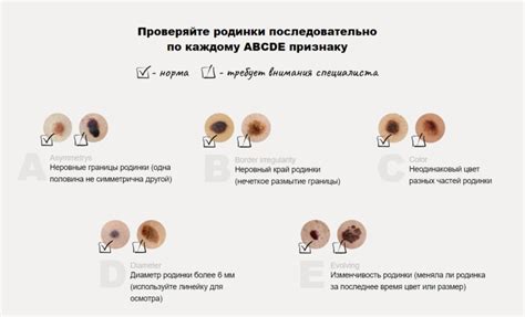 Воздействие гормонального фона на формирование родинок