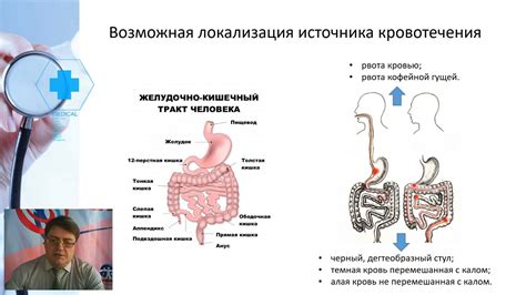 Воздействие на желудочное кислотообразование