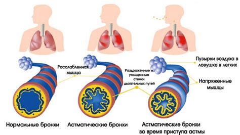 Возможная причина - проникновение воздуха в систему