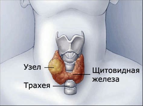 Возможное влияние различных окружающих факторов на увеличение щитовидной железы