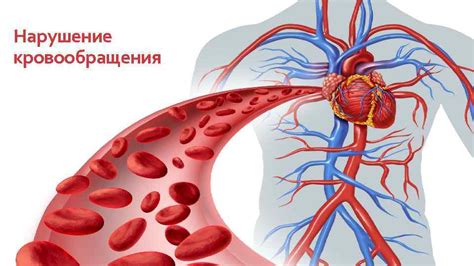 Возможное нарушение кровообращения