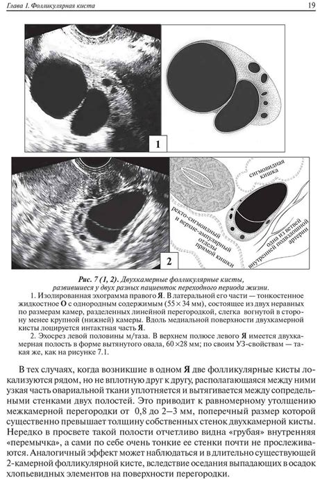 Возможность образования кист и опухолей