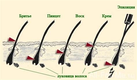 Возможность повышения риска инфекций после бритья волос на животе