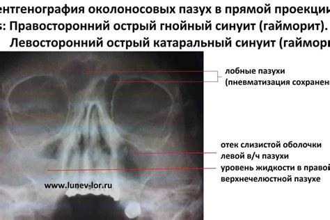 Возможные заболевания и патологии