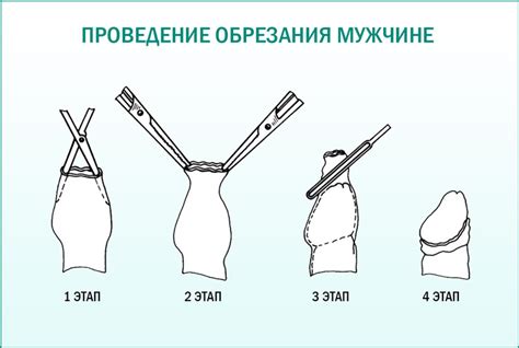 Возможные медицинские показания для обрезания у мужчин