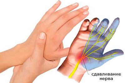 Возможные патологии, вызывающие онемение пальцев рук после употребления алкоголя