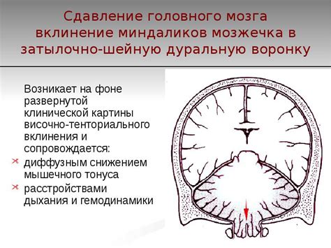 Возможные повреждения мозга