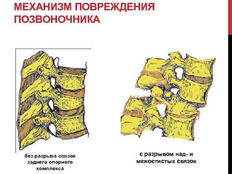 Возможные повреждения позвоночника