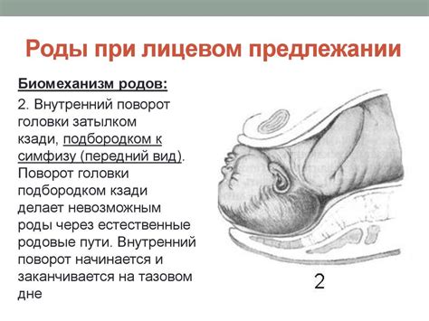 Возможные последствия головного предлежания и его коррекция