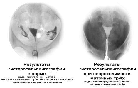 Возможные последствия дребезжания труб