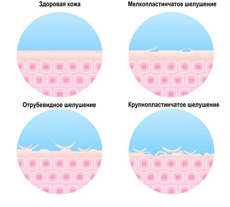 Возможные причины и сроки шелушения татуировки