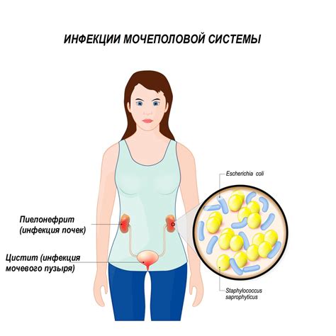 Возможные причины образования хлопьев в моче у мужчин