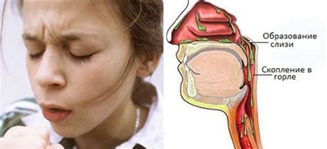 Возможные причины появления слизи в носоглотке ночью