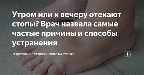 Возможные причины спазмов стопы и способы их устранения