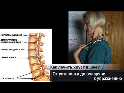 Возможные причины хруста позвоночника у ребенка при подъеме на руки