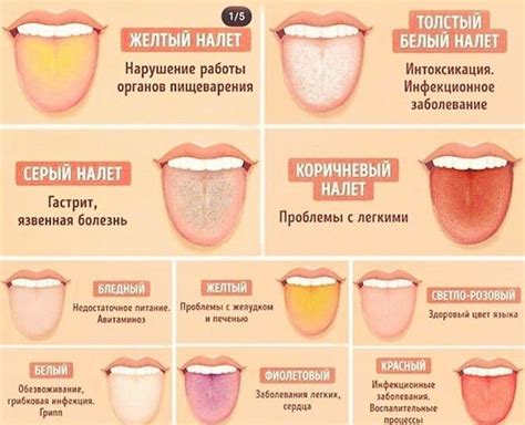 Возможные проблемы со лрингофоном