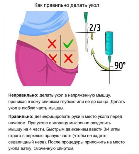 Возможные риски колоть глиатилин в ягодицу