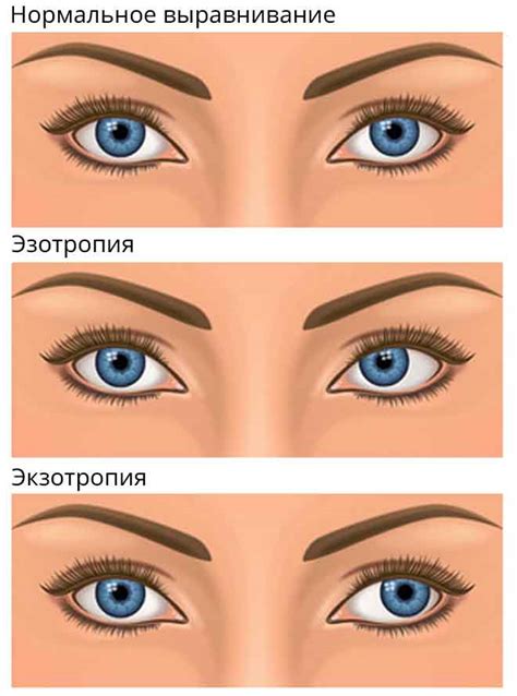 Возможные способы лечения красных линий на глазах: