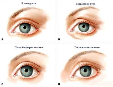 Возрастные особенности разреза глаз