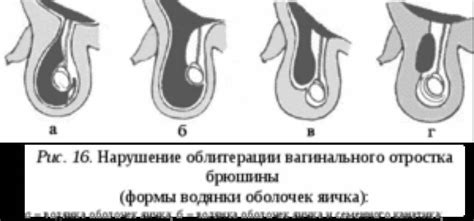 Воспаление яичек: симптомы и последствия