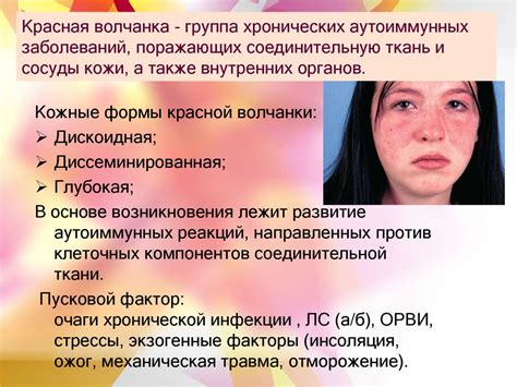 Воспалительные заболевания кожи