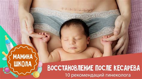 Восстановление спины после кесарева – важный этап после операции