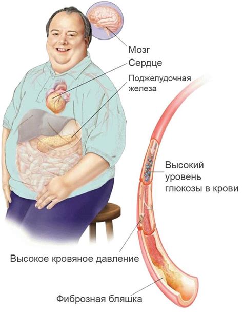 Вредные последствия сахарного диабета