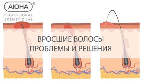 Вросшие волосы: проблема и способы решения