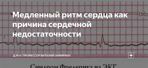 Вторая причина: укладывание в ритм