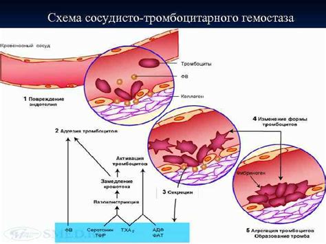 Выбор гемостатиков