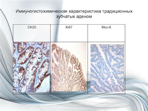 Выбор сорта и генетические особенности