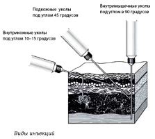 Выбор шприца