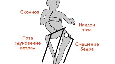 Выражение неправильной позы