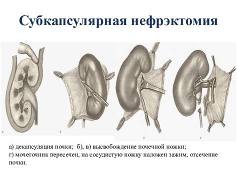 Высвобождение пространства