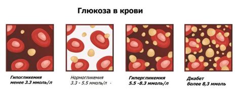 Высокий уровень глюкозы и снижение эластичности сосудов