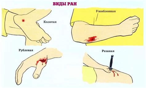 Вытирание ножа о себя увеличивает риск порезов и ран