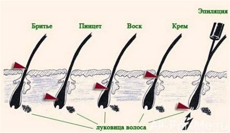 Выщипывание волос пинцетом: влияние на кожу и стимулирует ли рост волос