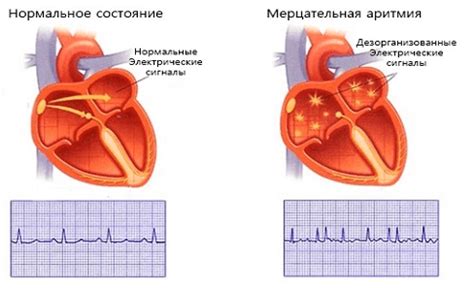 Выявление аритмий и сердечных заболеваний