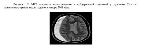 Выявление фобий и травм