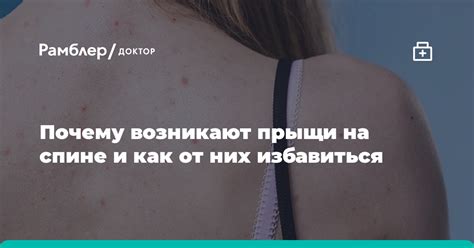 Выясняем, почему у подростка возникают прыщи на спине