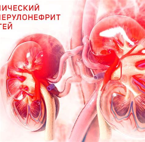 Гематурия и связь с нефротическим синдромом