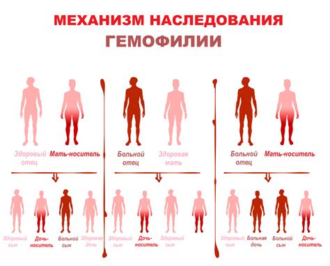 Гемофилия: причины, симптомы и диагностика