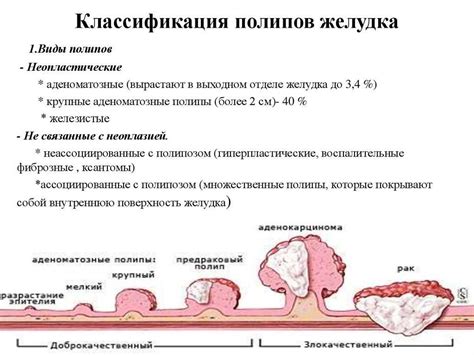 Генетические факторы риска миомы в матке