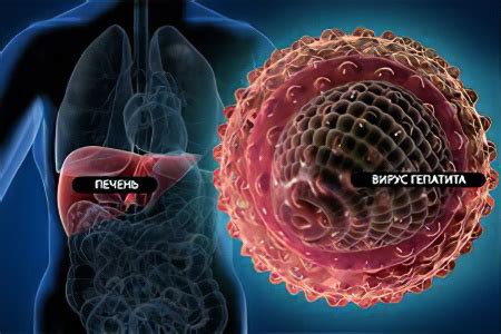 Гепатит: типы и возможные причины развития