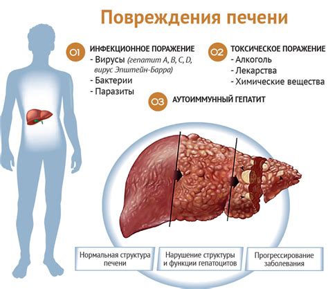 Гепатит и другие заболевания печени