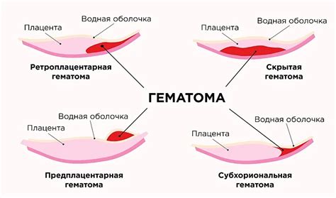 Гинекологические проблемы кошек - частая причина кровянистых выделений