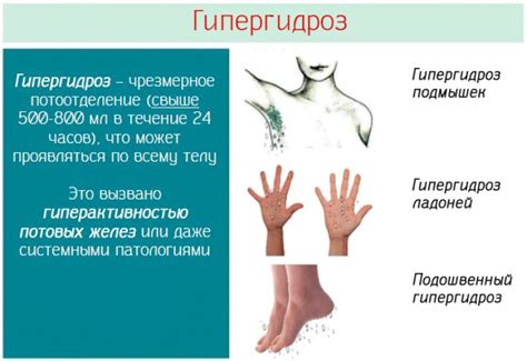 Гипергидроз и перспирация