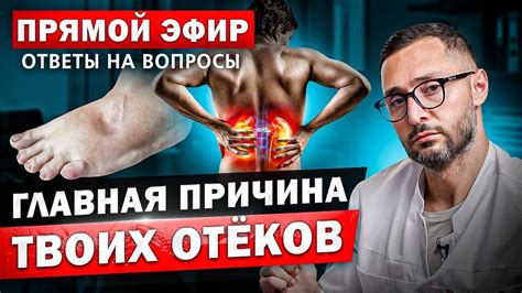 Главные причины отеков и болей